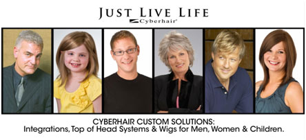 Hair loss systems